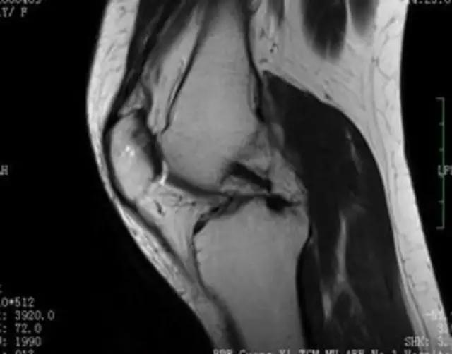 mri临床医师必读电子书,临床医生如何读mri