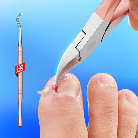 夏季脚怎么护理,夏季脚趾甲