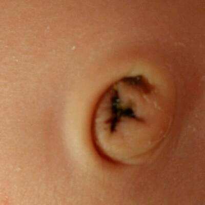 人体有5个部位不要清洗太干净,宝宝身上弄的油污怎么洗