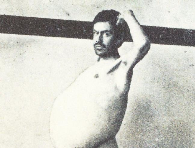 便秘能致人死亡吗,人会因为便秘而死吗