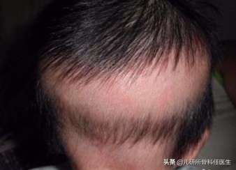 孩子走路太早对腿有什么伤害,宝宝站立早会罗圈腿吗