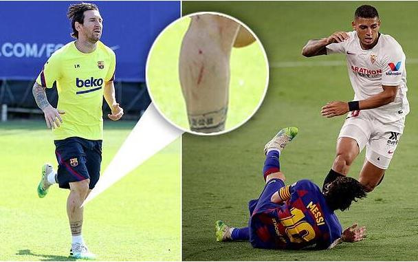 梅西受争议判罚,梅西遭飞踹造红牌全过程