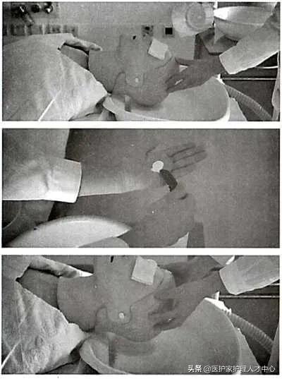 护理老人头发梳理与清洁,头部清理护理套餐