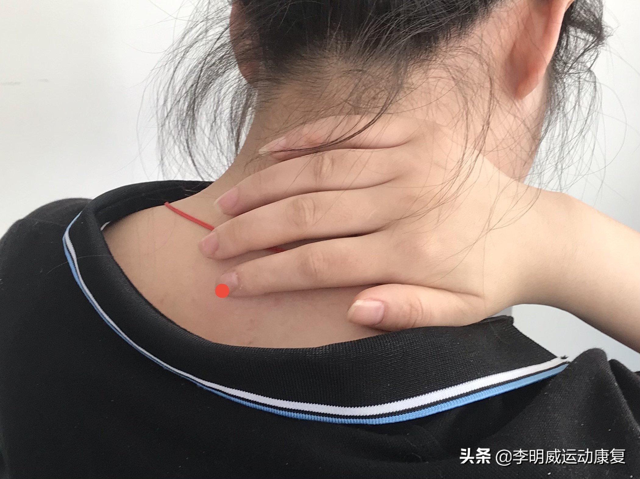 富贵包怎么消除最好方子,富贵包怎么消除视频教学