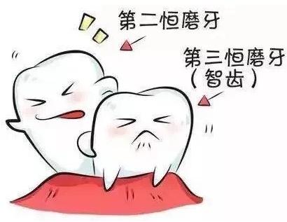 智齿引发的冠周炎多久可以拔牙,智齿引发的冠周炎是什么症状