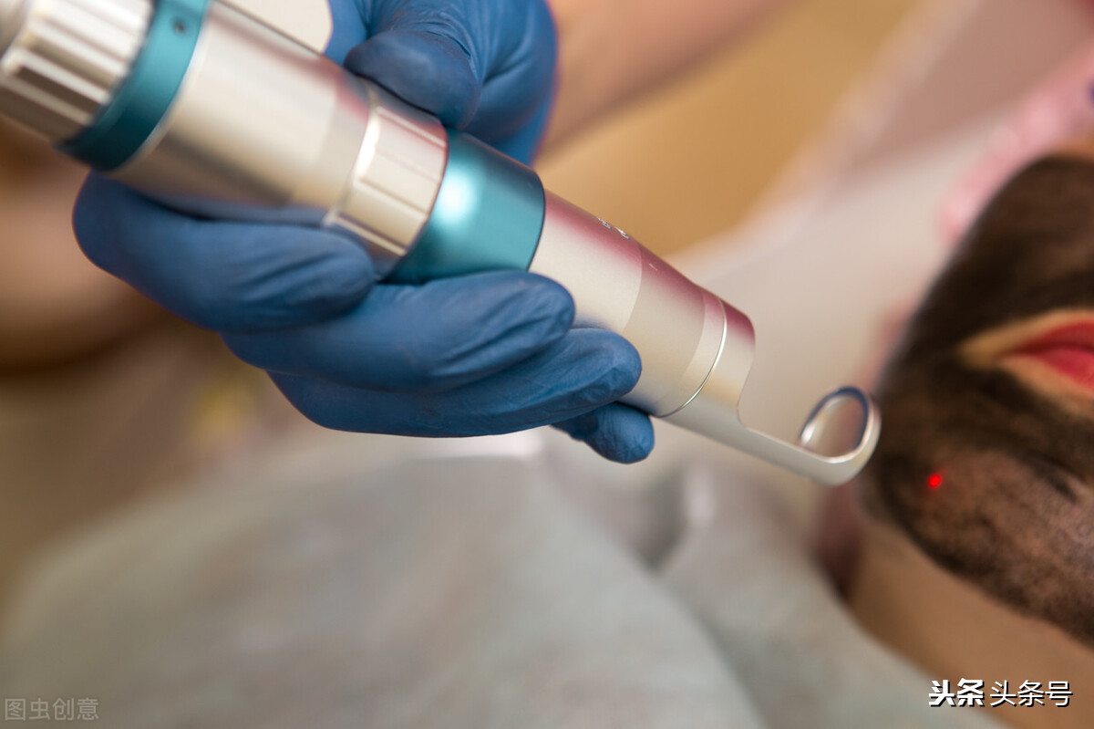 脸上有疤痕怎么去除真实案例,脸上有外伤疤痕怎么去除