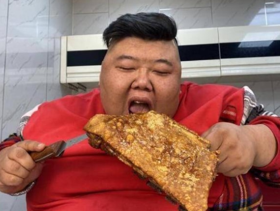 千万网红小贝近况堪忧，面容憔悴法令纹深，网友：都是催吐惹的祸