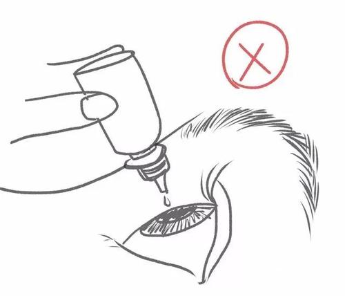 眼科医院滴眼液一览表,眼科滴眼操作