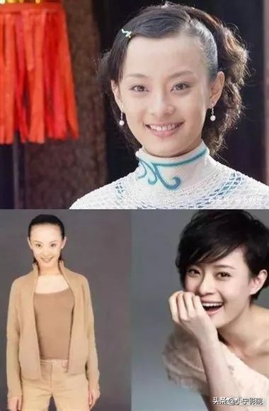 程潇发际线变高的原因为什么,程潇发际线怎么变低了