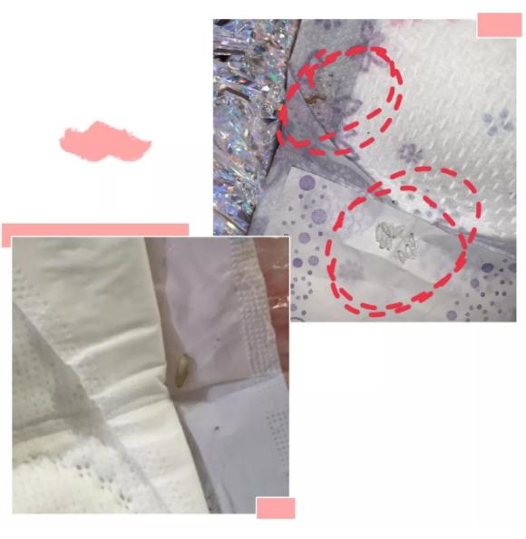 苏菲卫生巾里小虫子怎么处理,卫生巾上有黄色的小虫子