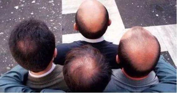 脱发严重用什么方法头发再次生长,初中生脱发严重怎么生发