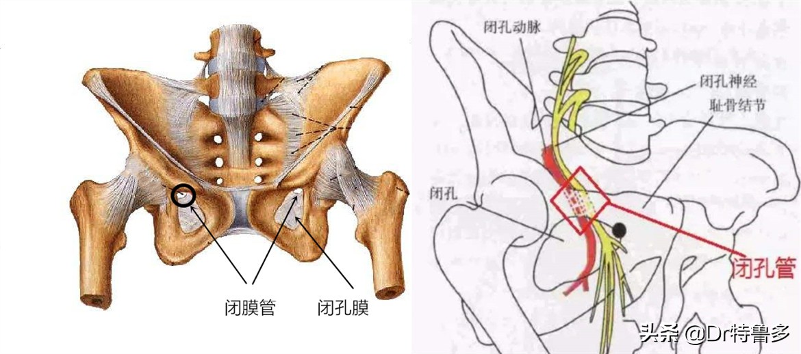 大腿内侧疼是压迫哪根神经引起的,大腿内侧神经疼要警惕