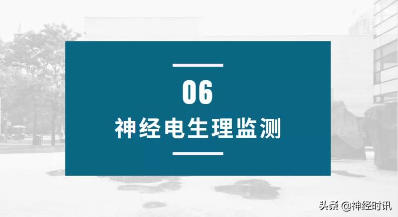 脑卒中病情监测指南,2018急性脑卒中指南ppt