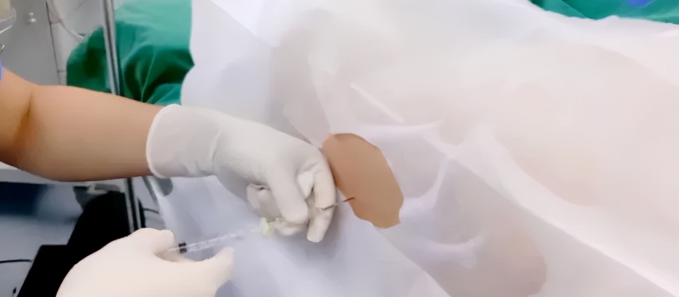 关于无痛分娩的真相孕妈要知道,带你揭秘无痛分娩的真相