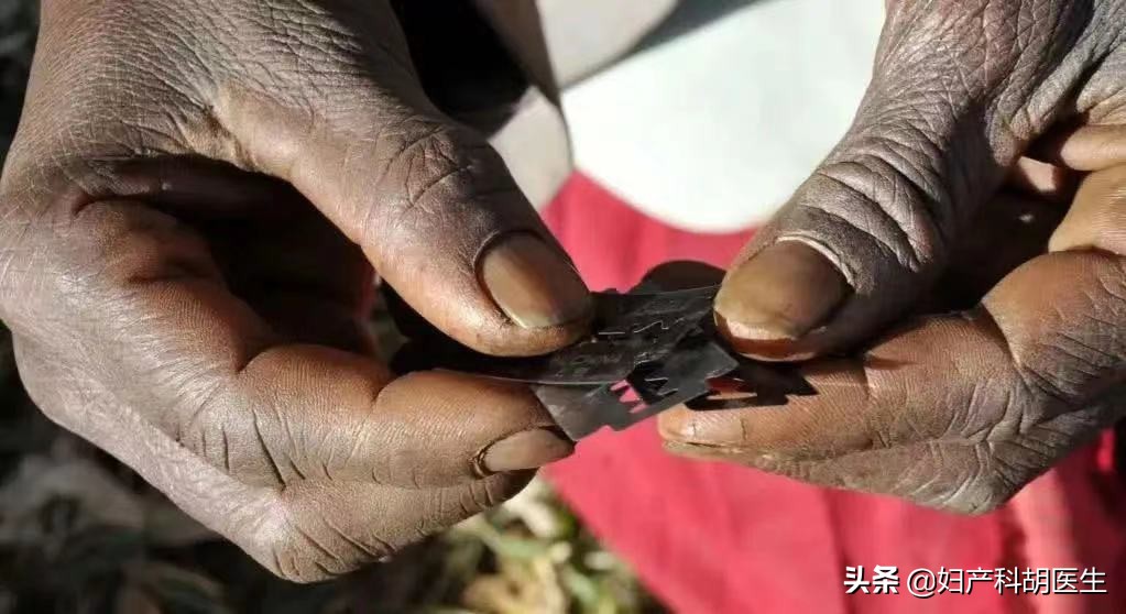 为了美丽,为了变美我把外阴切除了