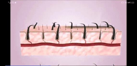 有了这个神器，英国人的脱发有救了？