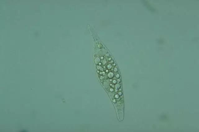 收藏!24种污水处理微生物菌相及指导意义,环保人必看(多图)