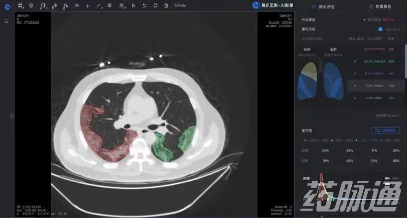 刚刚!腾讯拿证,正式生产医疗器械