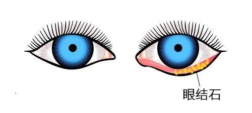 长期熬夜看剧的危害,经常熬夜追剧有什么危害