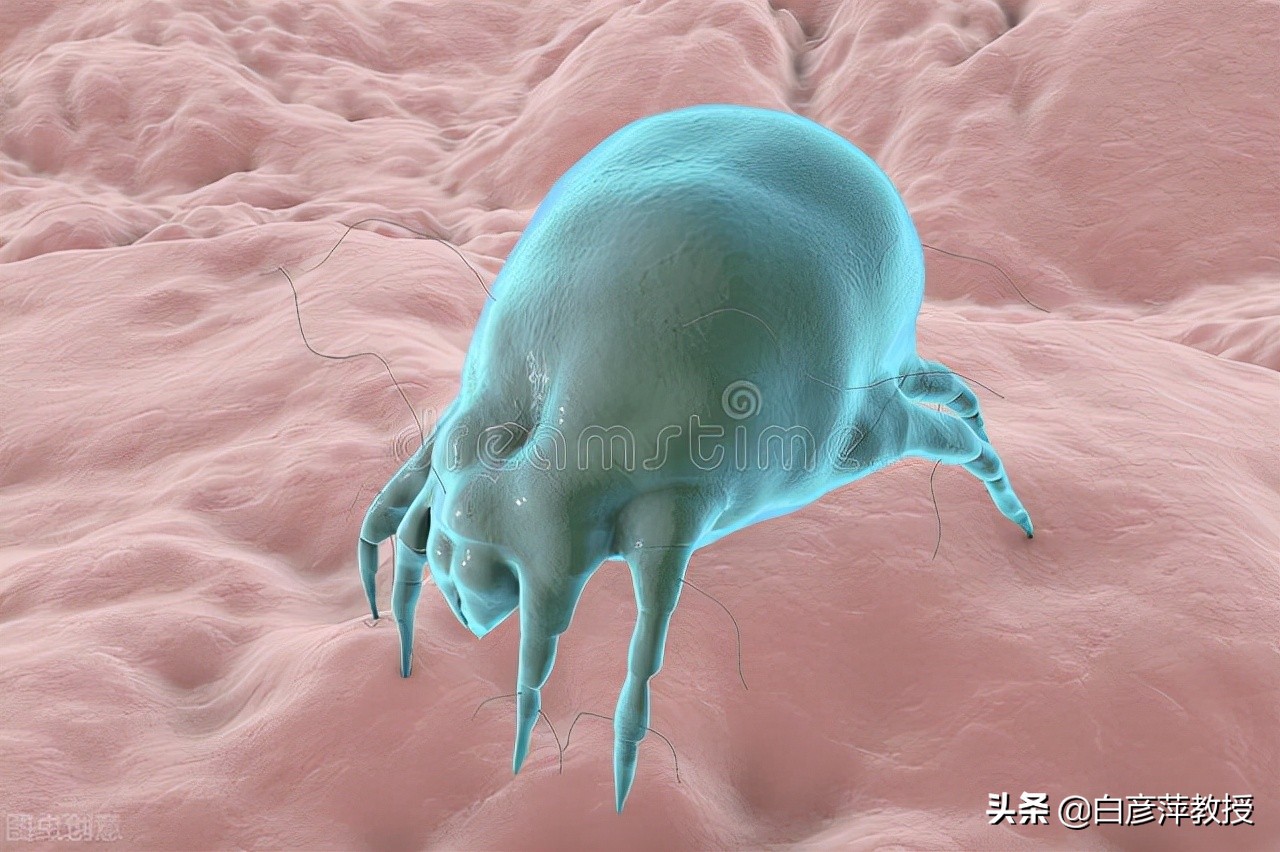 疥疮？一种奇痒又会传染的皮肤疾病
