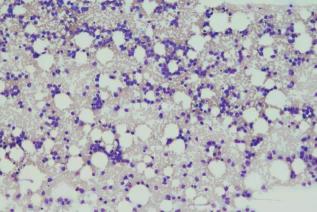 粒单不决问组化?有时还真不一定...