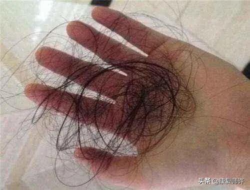 产后腹直肌分离恢复瘦肚子训练,产后腹直肌分离恢复的最佳方法