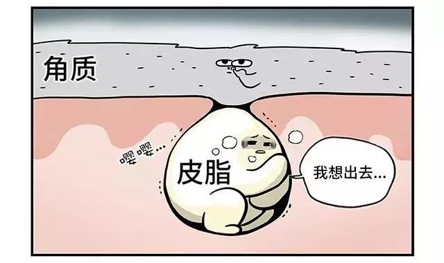 长了粉刺怎么处理,长了闭合粉刺性痤疮怎么办