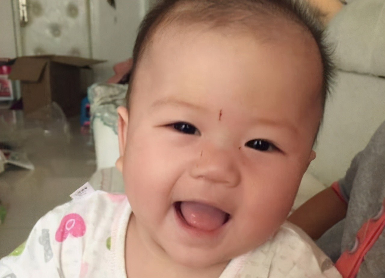 宝宝总是把自己挠破,宝宝老是挠破怎么办