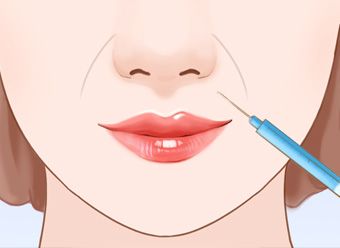 瘦脸针三针是否真的定型,瘦脸针是什么原理有副作用吗