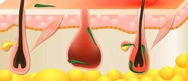 犬蠕形螨虫用什么药,犬蠕形螨显微镜形态