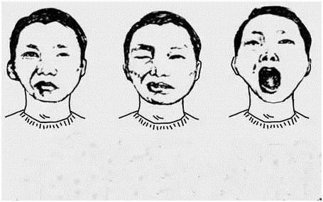 眼皮跳是财还是祸,眼皮一直跳会影响运气