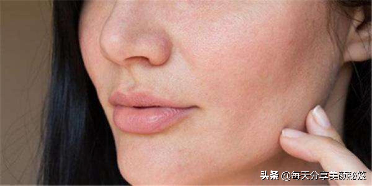 接触性皮炎用皮炎平有用吗,脸部接触性皮炎用什么药膏