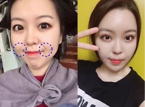 改善眼角细纹的方法有哪些,眼角皱纹细纹怎么去掉