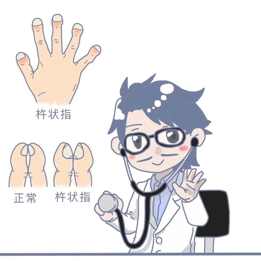 肺癌多大的概率会误诊,死亡率仅次于癌症的病