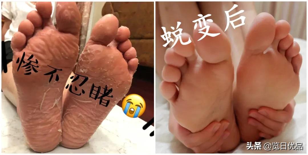爽炸了!干丑裂的脚皮,一张完整撕掉,敢跟婴儿比姣嫩!