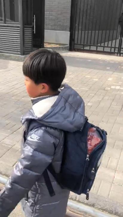 爱尔眼科4岁儿童视力检测准吗,眼科专家教孩子护眼