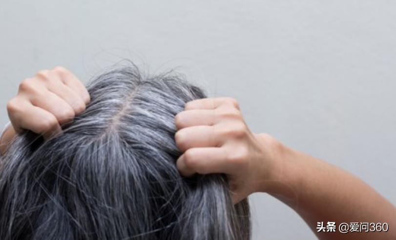 头发白严重怎么补救,头发白是什么原因怎么改善