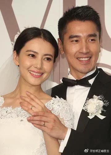 宝宝笑起来露牙龈是什么原因,牙齿矫正露牙龈笑怎么办