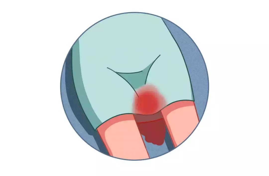 产妇恶露颜色呈青色,恶露是什么颜色说明已经排干净了