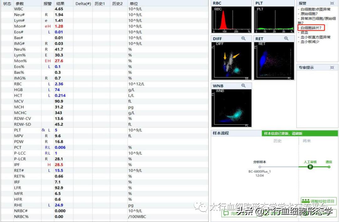 浆质体是什么,浆质体图片