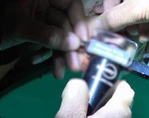 小朋友手指被夹流血,漯河1岁女童手指被夹断