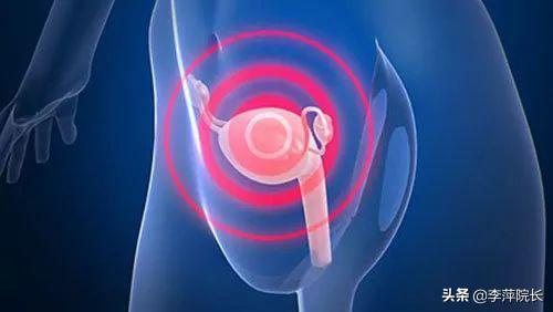 子宫内膜异位症怎么会影响肺部,子宫内膜异位症怀孕能吃泼尼松吗