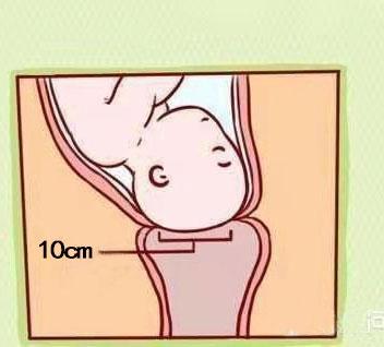 顺产“宫口开十指”，别真以为是“十根手指宽”......