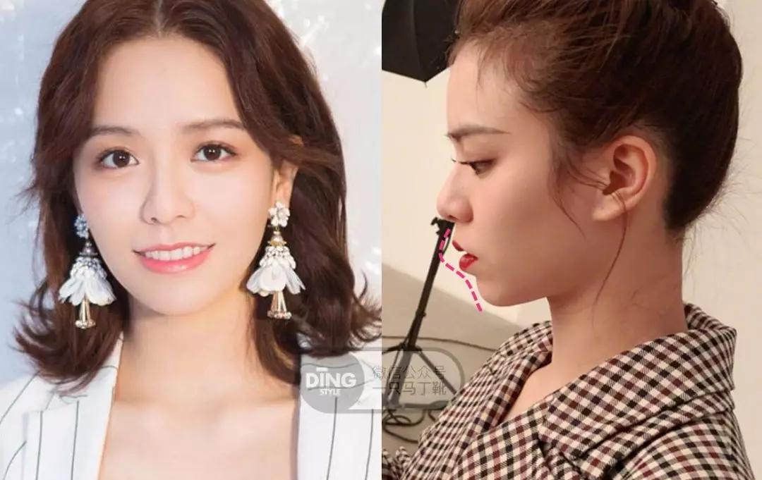 戴牙套凸嘴怎么化妆,凸嘴整牙削骨吗