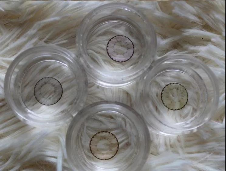 儿童角膜溃疡严重会穿孔吗,儿童角膜溃疡