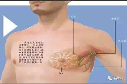 男性也会得乳腺癌?丽水男子得乳腺癌,全乳切除!有这种症状的男性朋友要重视了