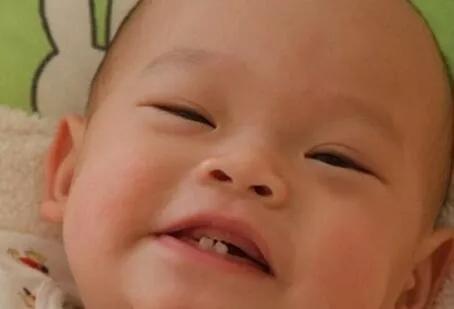 换牙后新牙锯齿状怎么回事,小孩换牙后长出来的牙是锯齿状的