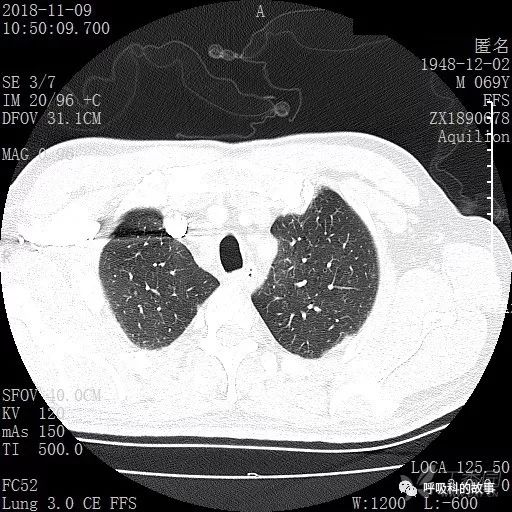 怎么应用统计学做调查,统计学方法可以解决的主要问题