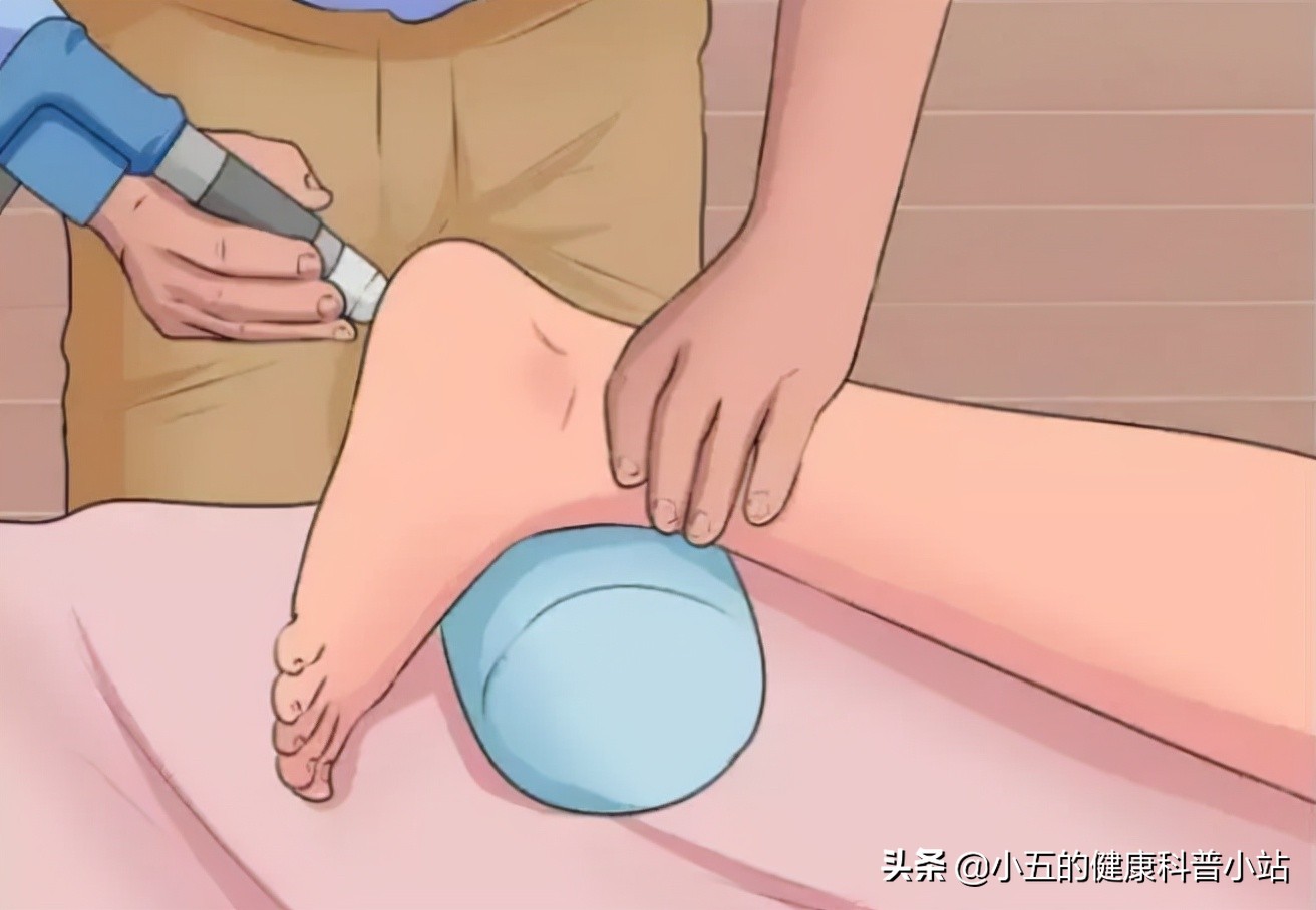 足跟痛的原因和治疗方法,足跟痛的快速解决办法