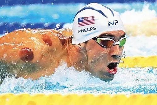 足球队医药箱应备哪些药物,足球队医用药箱准备